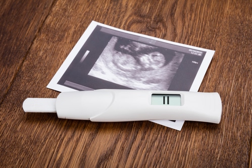 Ultrasound blog pregnancy test -